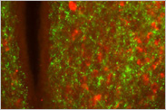 NPY fibers (green) and dynorphin A containing fibers and neurons (red) in the paraventricular nucleus of the mouse