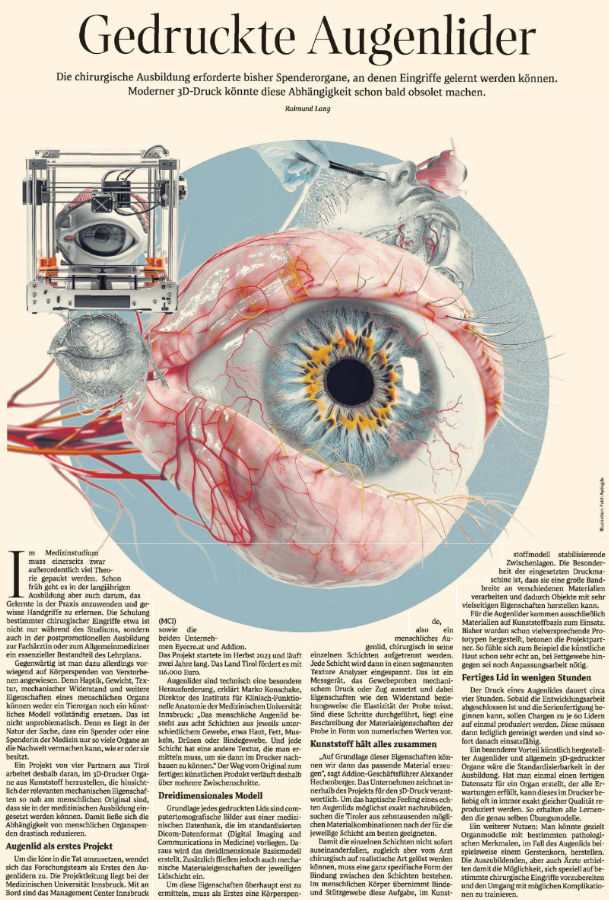 Der Standard berichtet in der Ausgabe vom 17. April 2024 über  3D gedruckte Augenlieder, ein Projekt das federführend vom Instituts für Klinisch-Funktionelle Anatomie und der Medizinischen Universität Innsbruck geleitet wird.