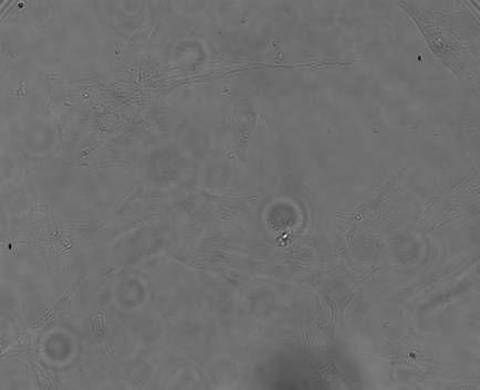 fibroblast_B_BF