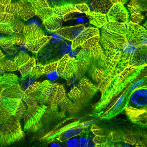 3D-Lungenzellkultur-in-Cellulose-Matrix