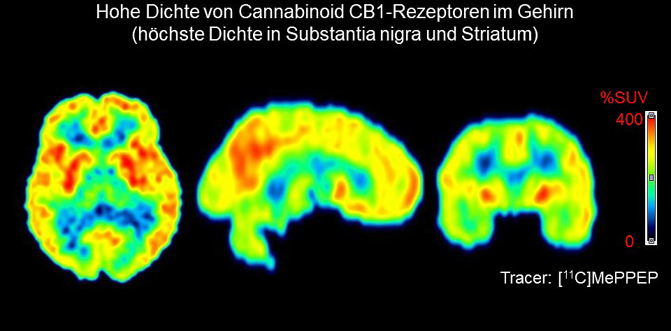 CB1-Rezeptoren-Gehirn.jpg