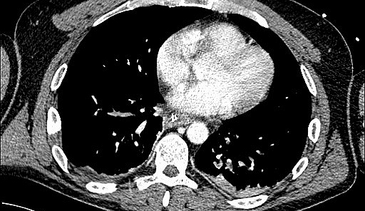 CT-Lunge.jpg
