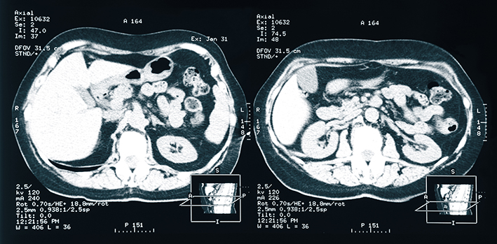 Kidney_MR_AdobeStock.jpg