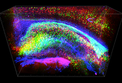 Dreidimensionale Ansicht von gefärbten Hippocampus: Neuronen (grün), Interneuronen (rot) und Gliazellen unterstützen (blau). Copyright: Deissenroth Labor.