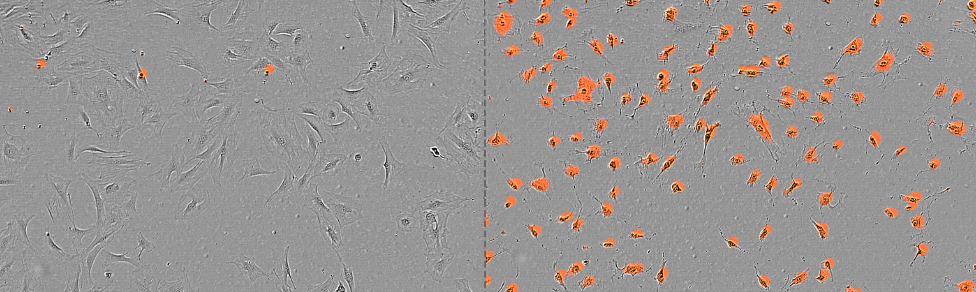 Glutamat-Stoffwechsel als Ziel von metabolischer Immuntherapie gegen schwarzen Hautkrebs