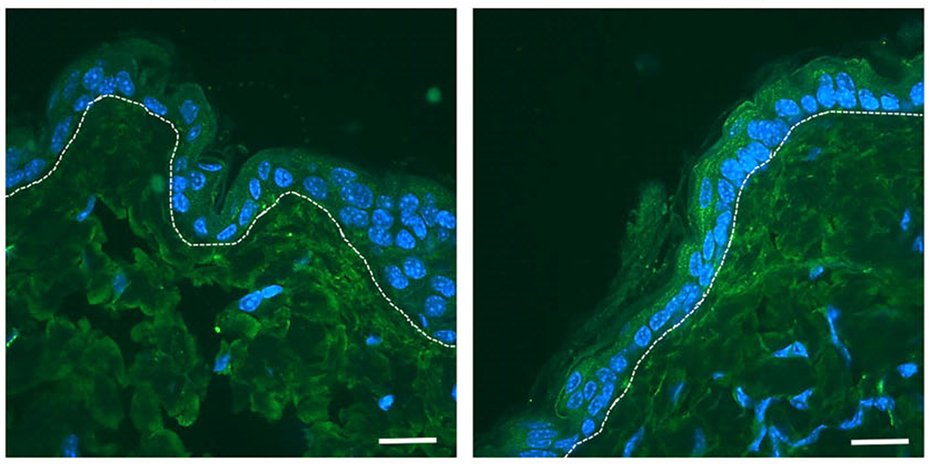 Ein PPARα reguliert Hautmikrobiom und Immunabwehr