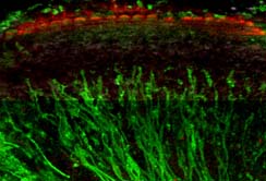 Mit Hilfe von Nanopartikeln könnten in Zukunft Hörschäden therapiert werden.