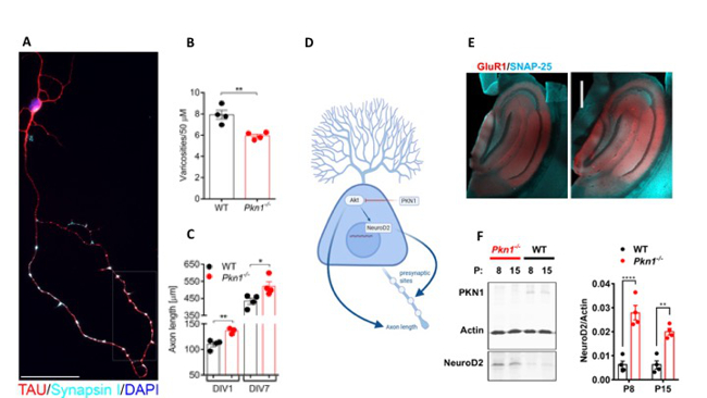 PKN1 functions as a developmentally active gate keeper of AKT and NeuroD2