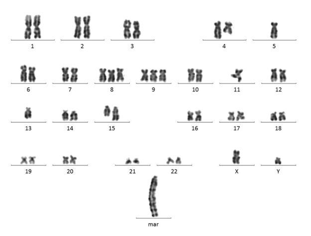 Aberrante Methaphase