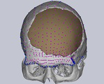 Modeling implants for large skull defects.